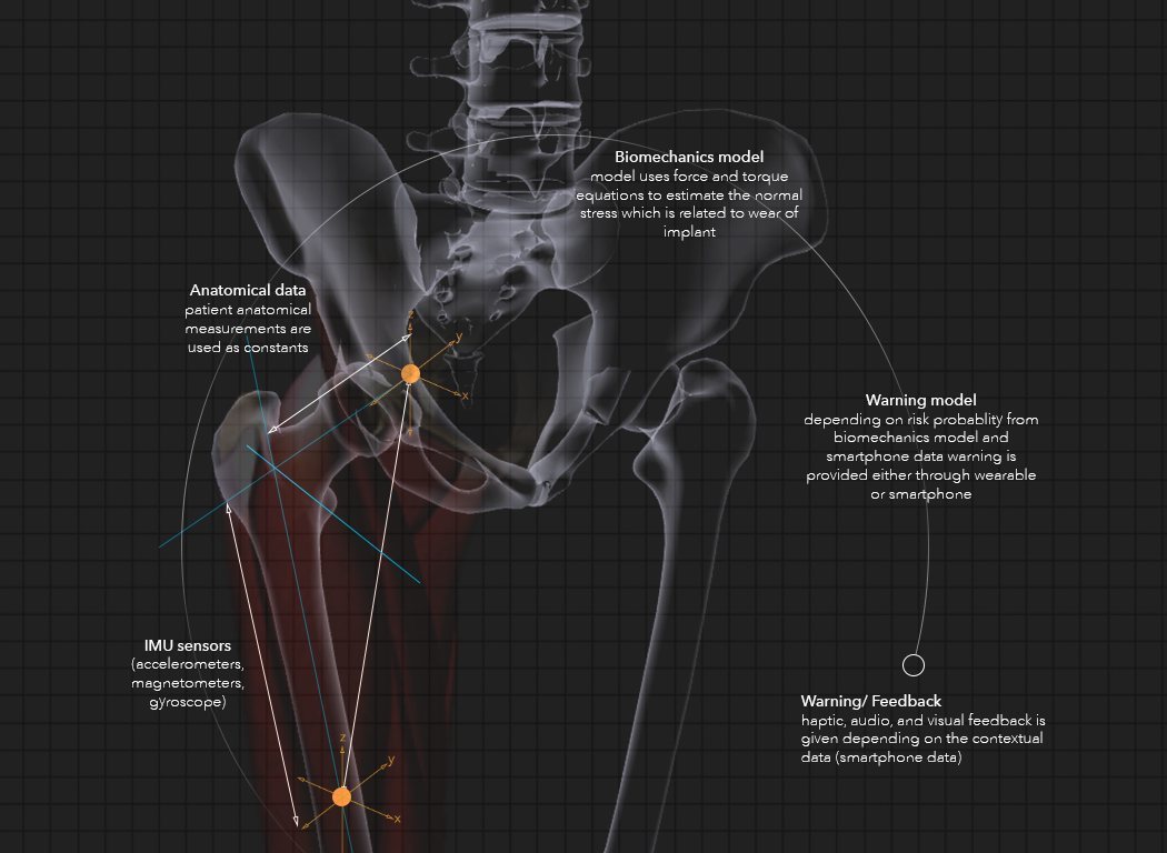 product design，industrial design，medical care，User experience，convenient，