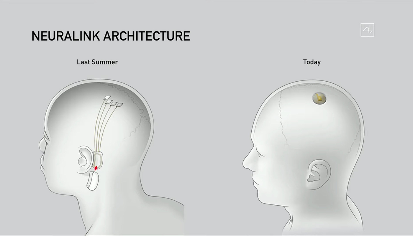 芯片，Neuralink，手术，机器人，脑植入，神经科学，