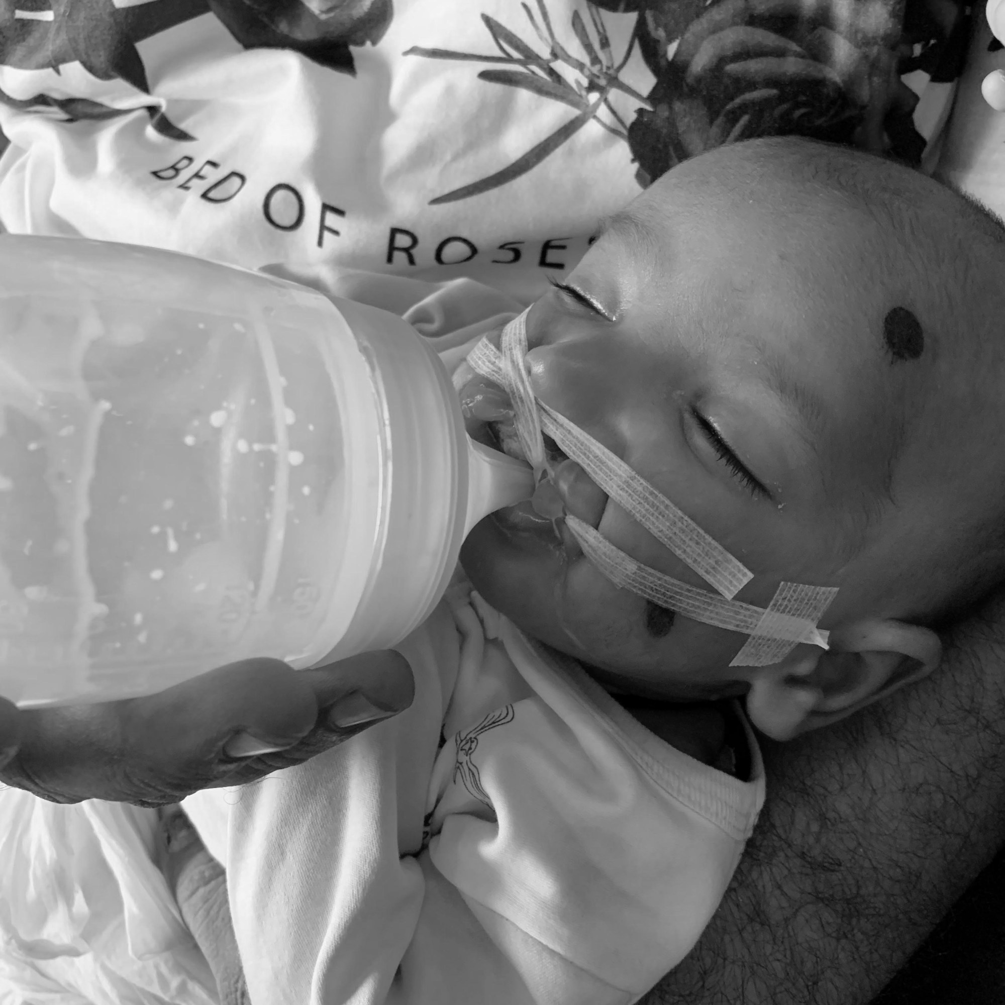 2020 red dot design concept award，feeding bottle，Boond ™，Feeding aid，cleft lip，