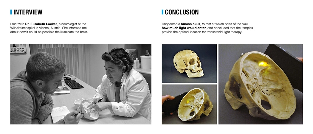 Phototherapy，wearable devices ，vitamin D，