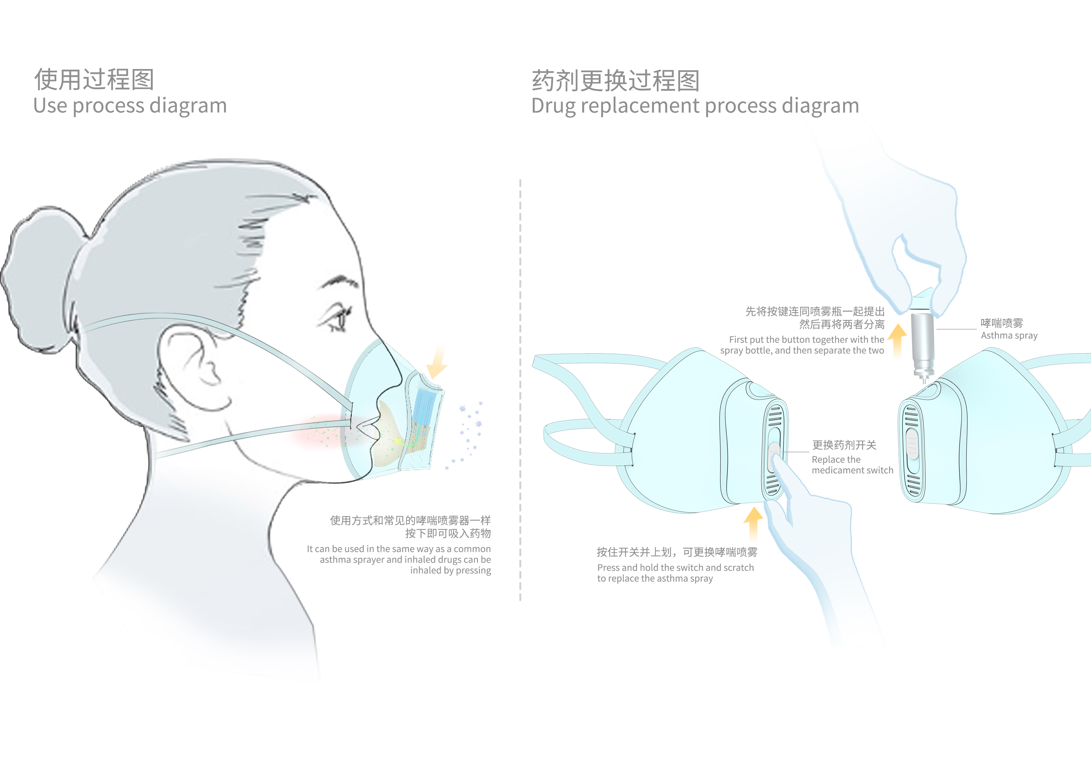 asthma，Mask design，Mask，