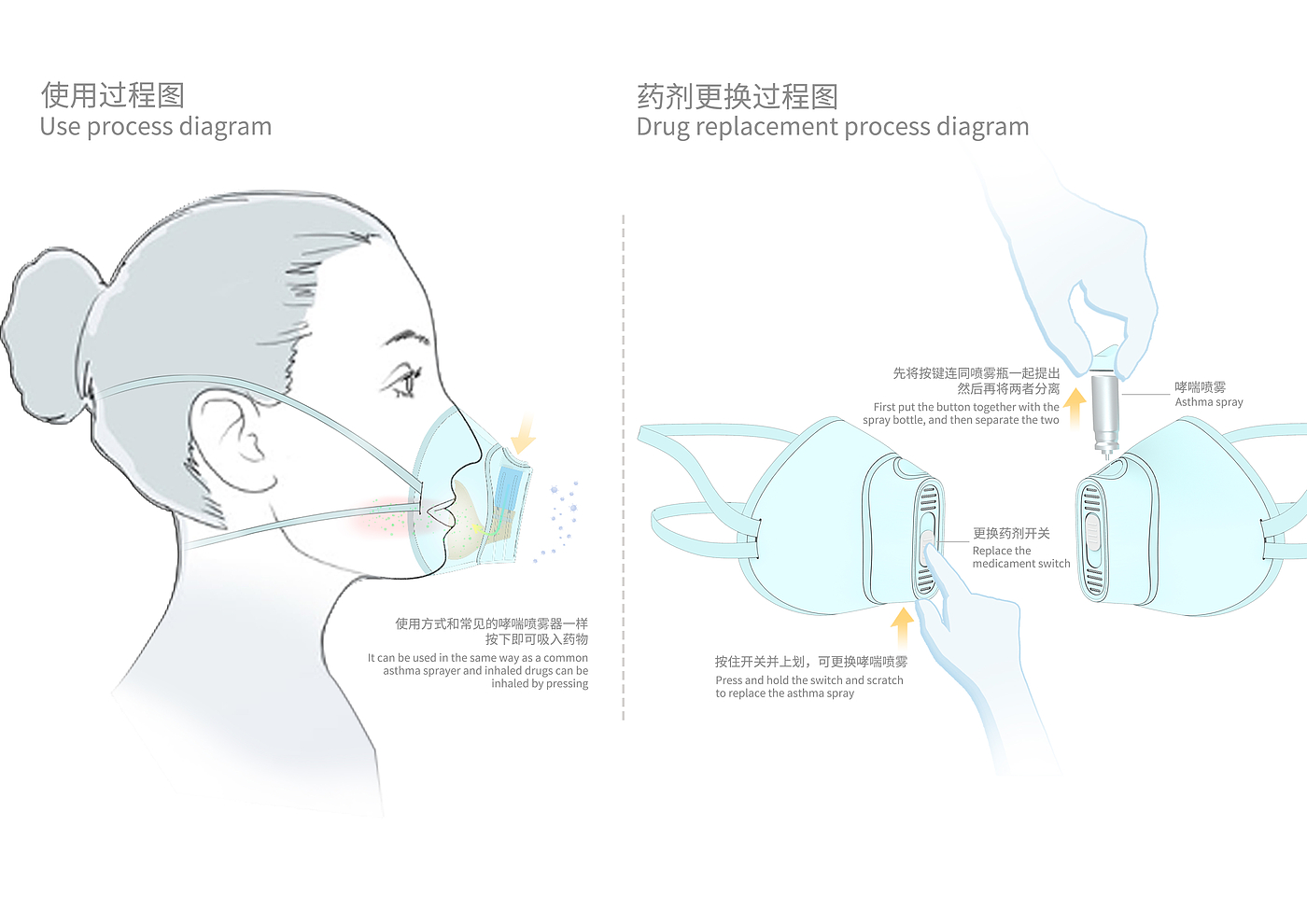 哮喘，口罩设计，口罩，