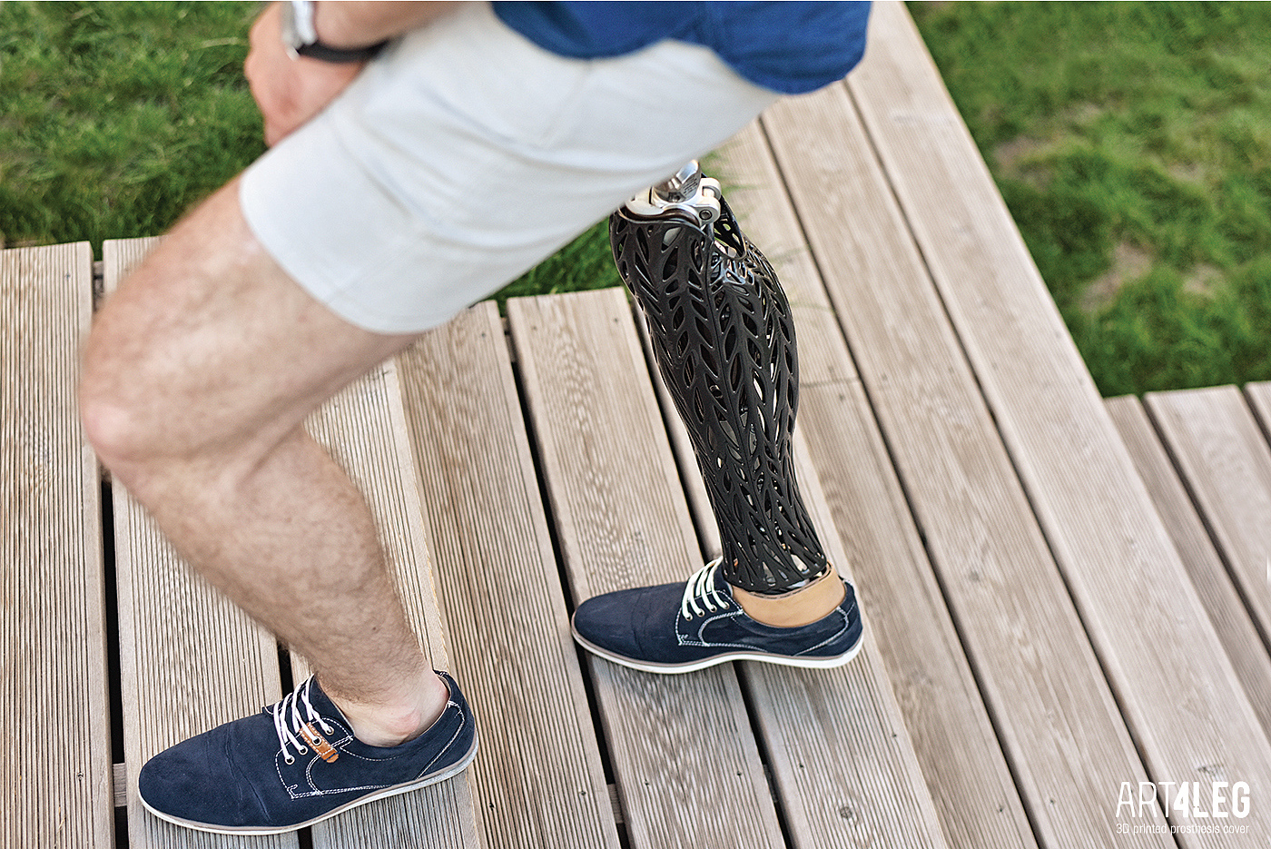 Prosthesis，3D printing，organic，customized，industrial design，
