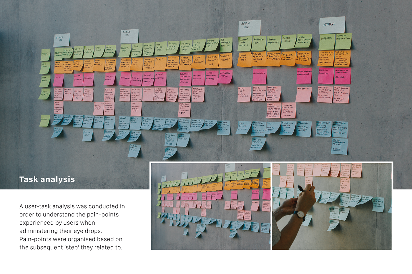 Eye drops，autonomy，glaucoma，