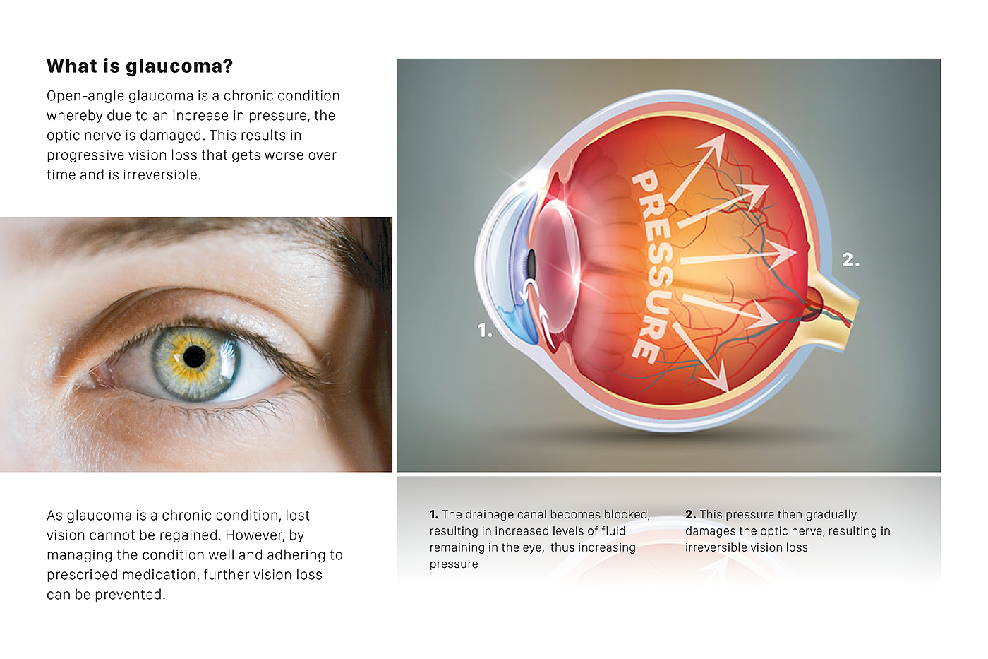 Eye drops，autonomy，glaucoma，