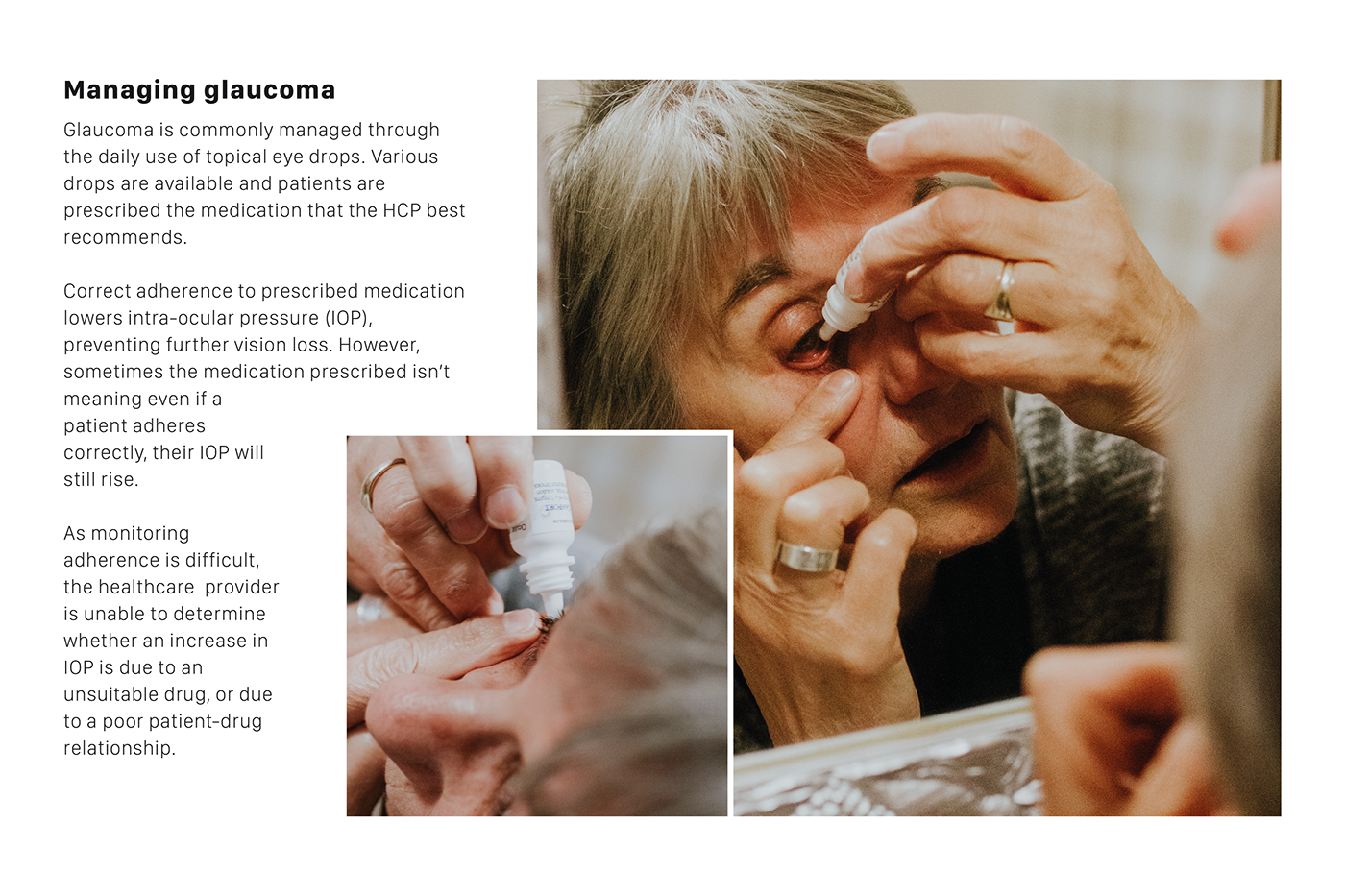 Eye drops，autonomy，glaucoma，