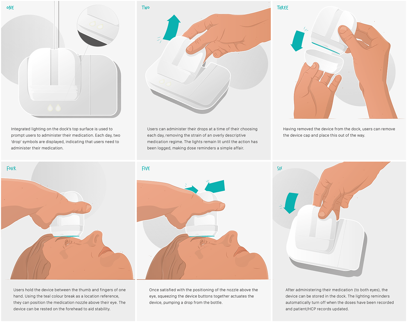 Eye drops，autonomy，glaucoma，
