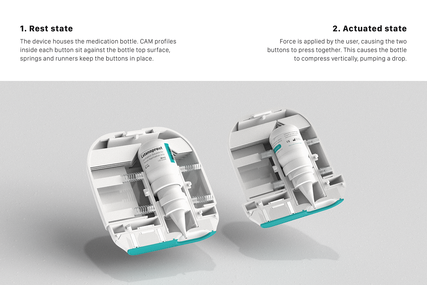 Eye drops，autonomy，glaucoma，