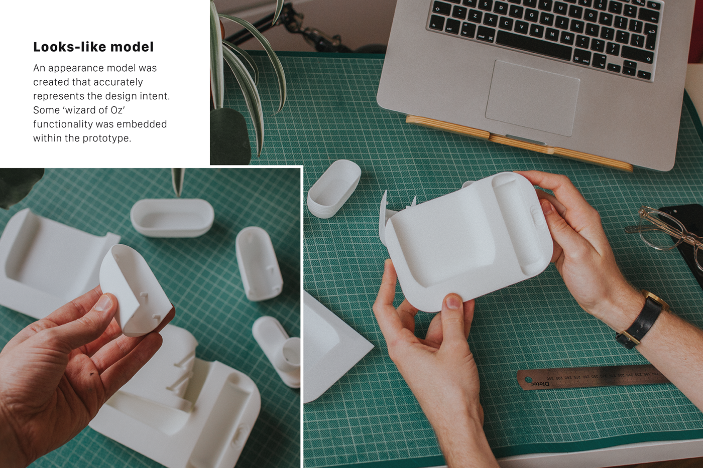 Eye drops，autonomy，glaucoma，