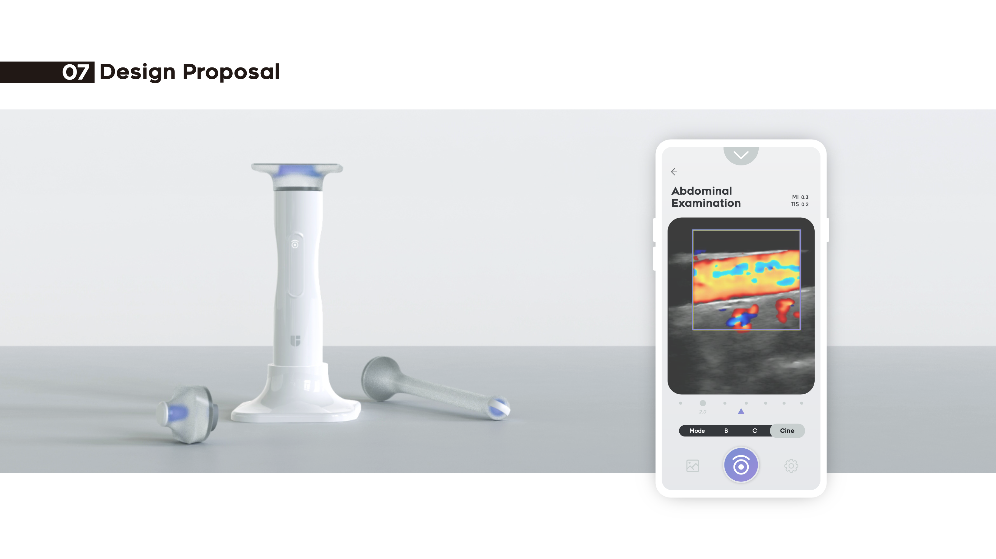 industrial design，product design，medical apparatus and instruments，b-mode ultrasonography，