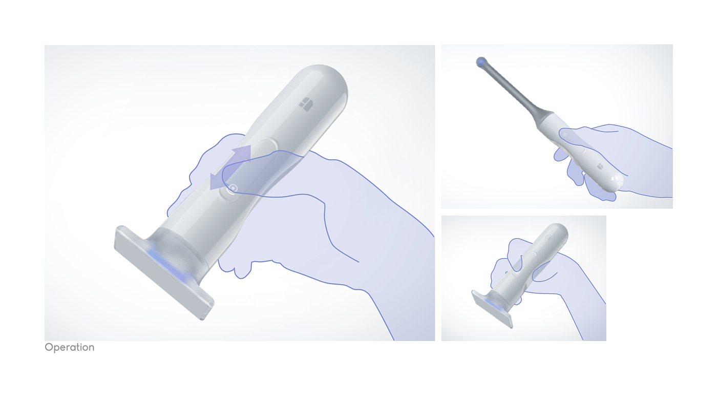 industrial design，product design，medical apparatus and instruments，b-mode ultrasonography，