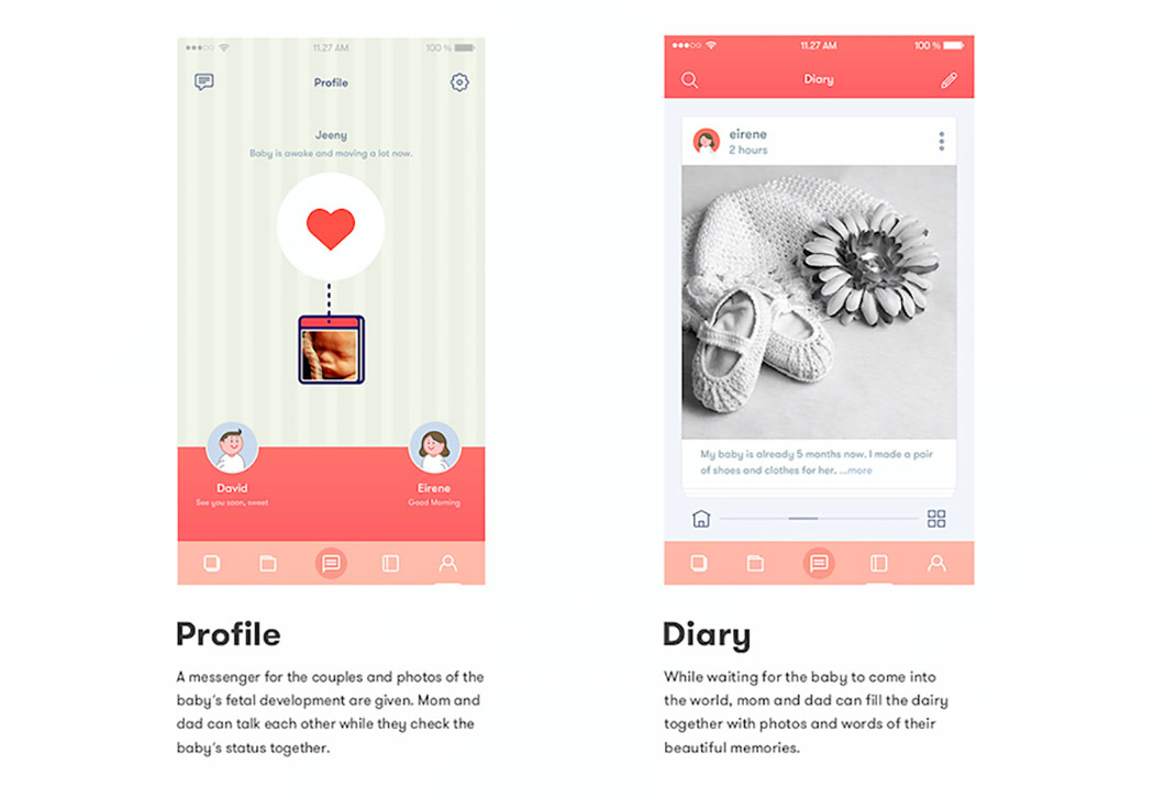 Intelligent device，Fetal movement test，Heart rate test，fetus，Monitor，