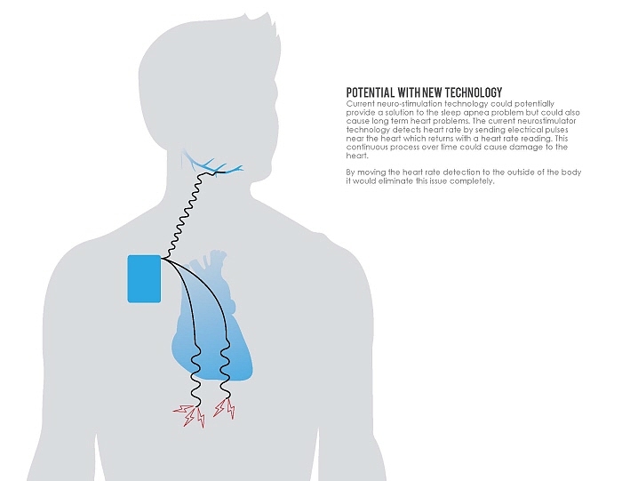 Medical products，