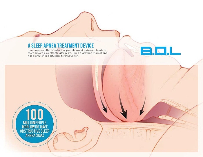 Medical products，