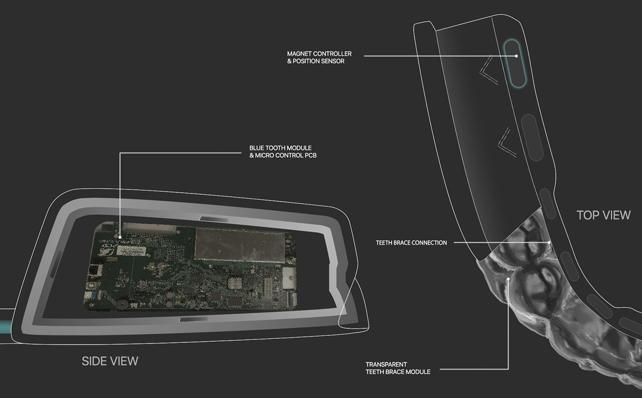 General image，Braces，Intelligent products，Medical products，oral cavity，