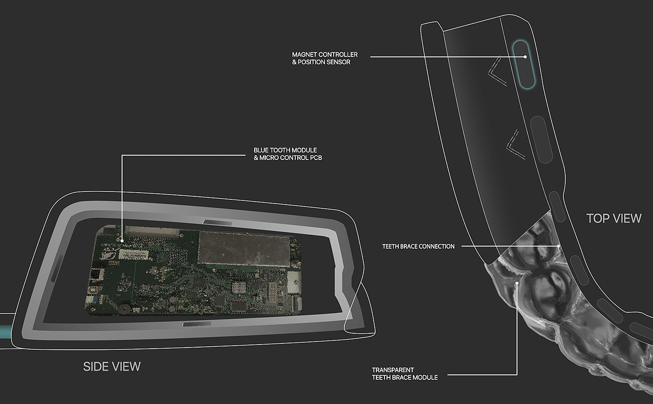 General image，Braces，Intelligent products，Medical products，oral cavity，