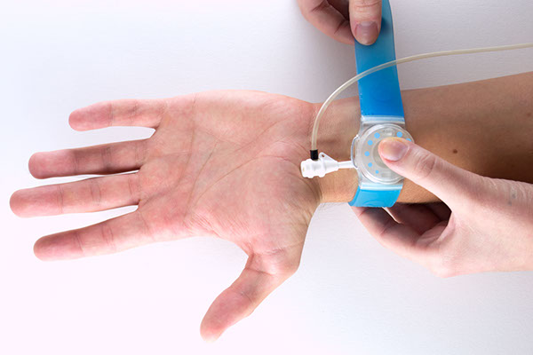 security，facilitate，Hemostatic instrument，radial，