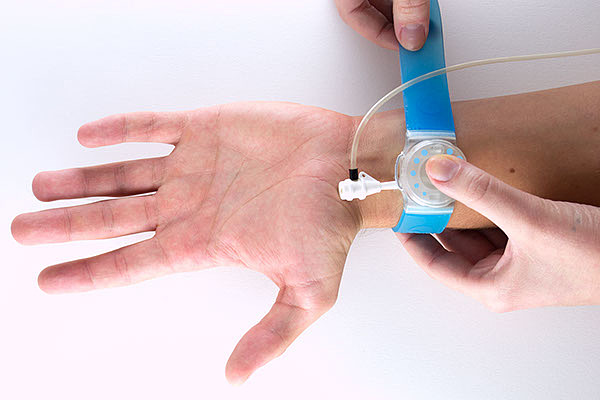 security，facilitate，Hemostatic instrument，radial，