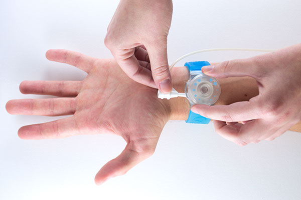 security，facilitate，Hemostatic instrument，radial，