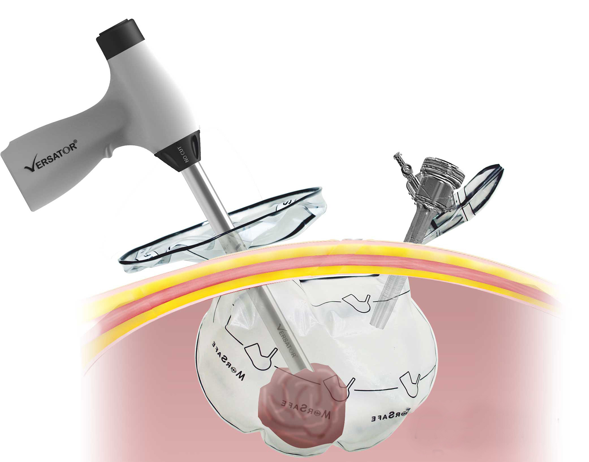 Medical products，Scalpel，Abdominal scalpel，Visceral cutter，