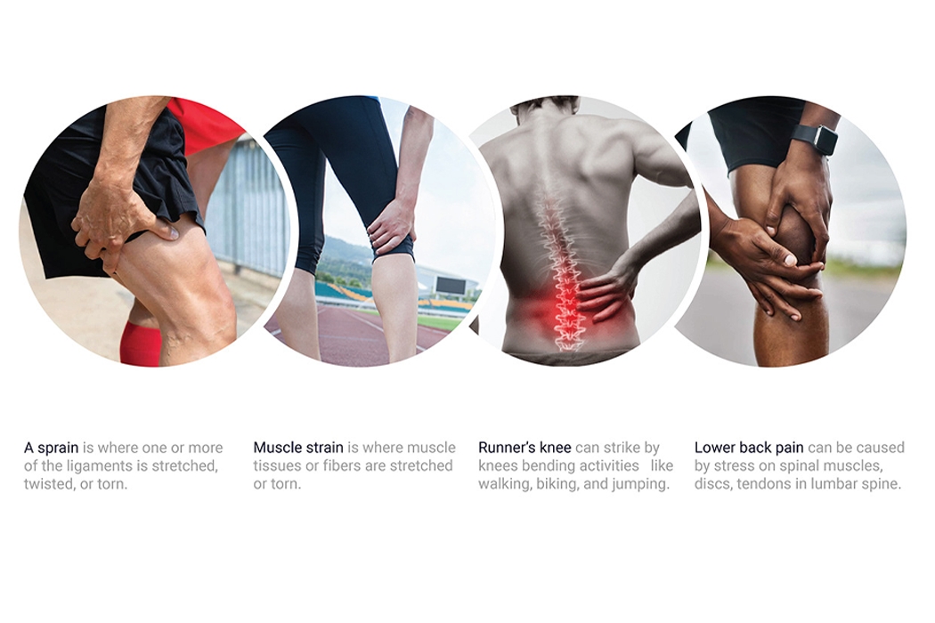 Treatment equipment，Physics，Hyperthermia，Cold therapy，Athletes，