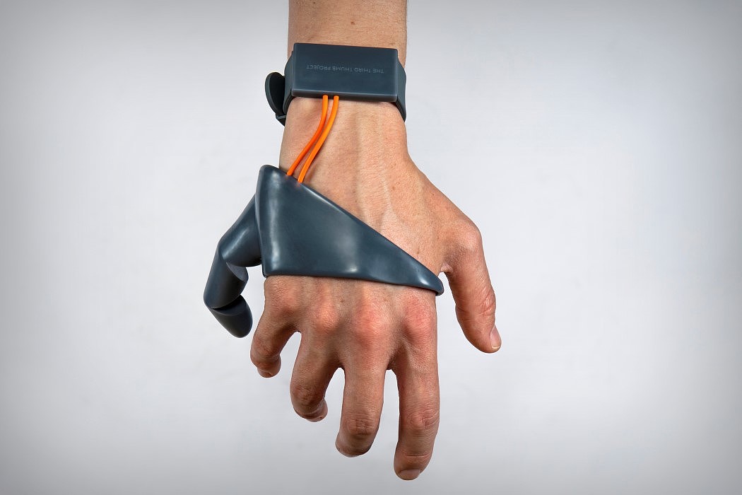 intelligence，a prosthesis，3D printing，