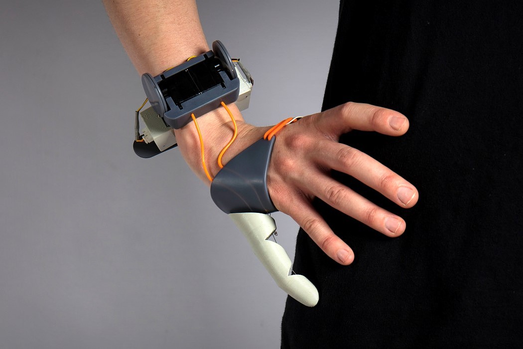 intelligence，a prosthesis，3D printing，
