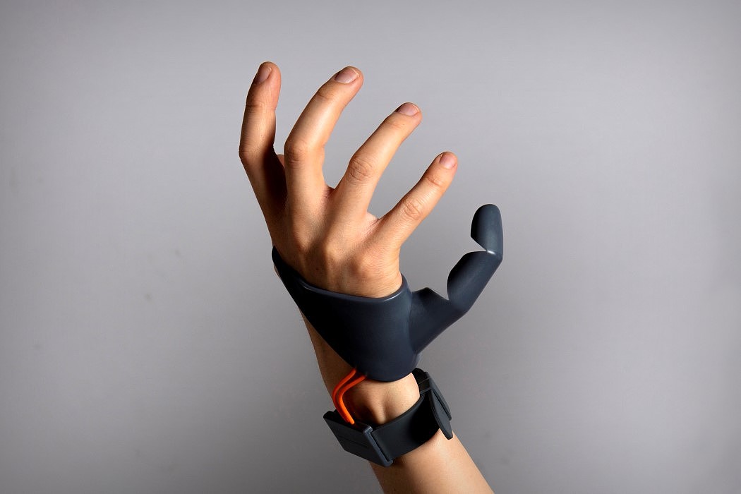 intelligence，a prosthesis，3D printing，