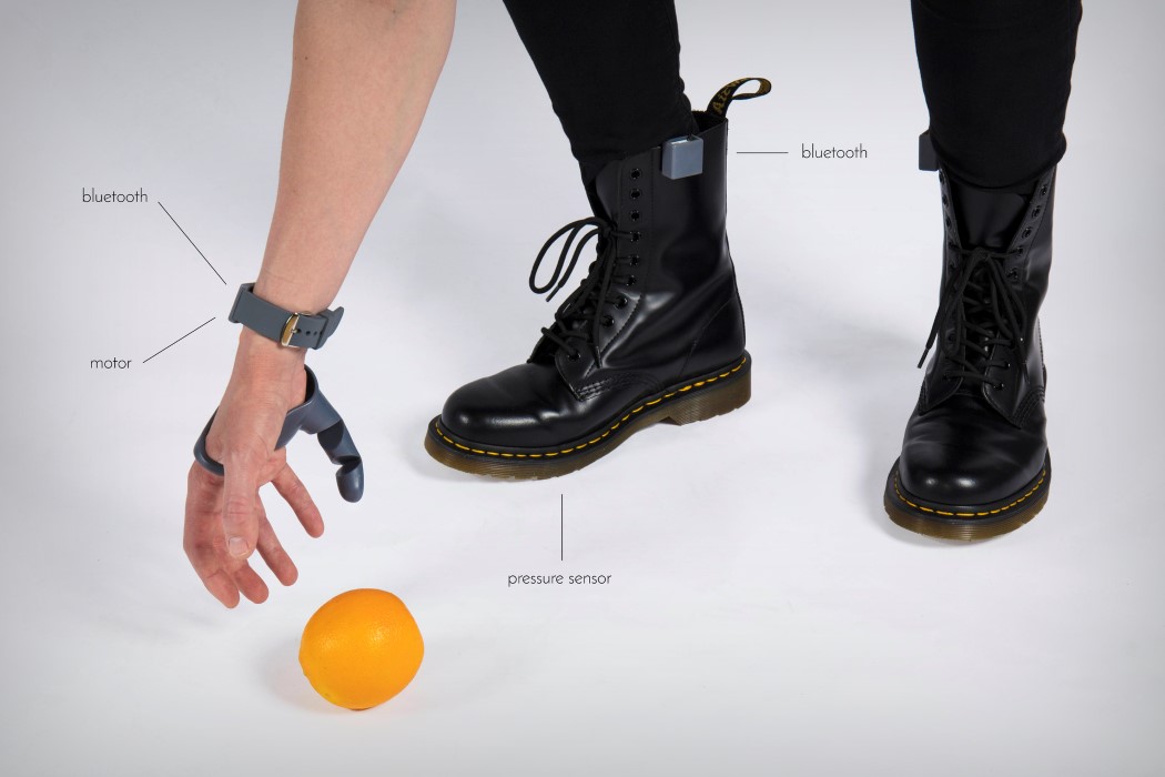 intelligence，a prosthesis，3D printing，