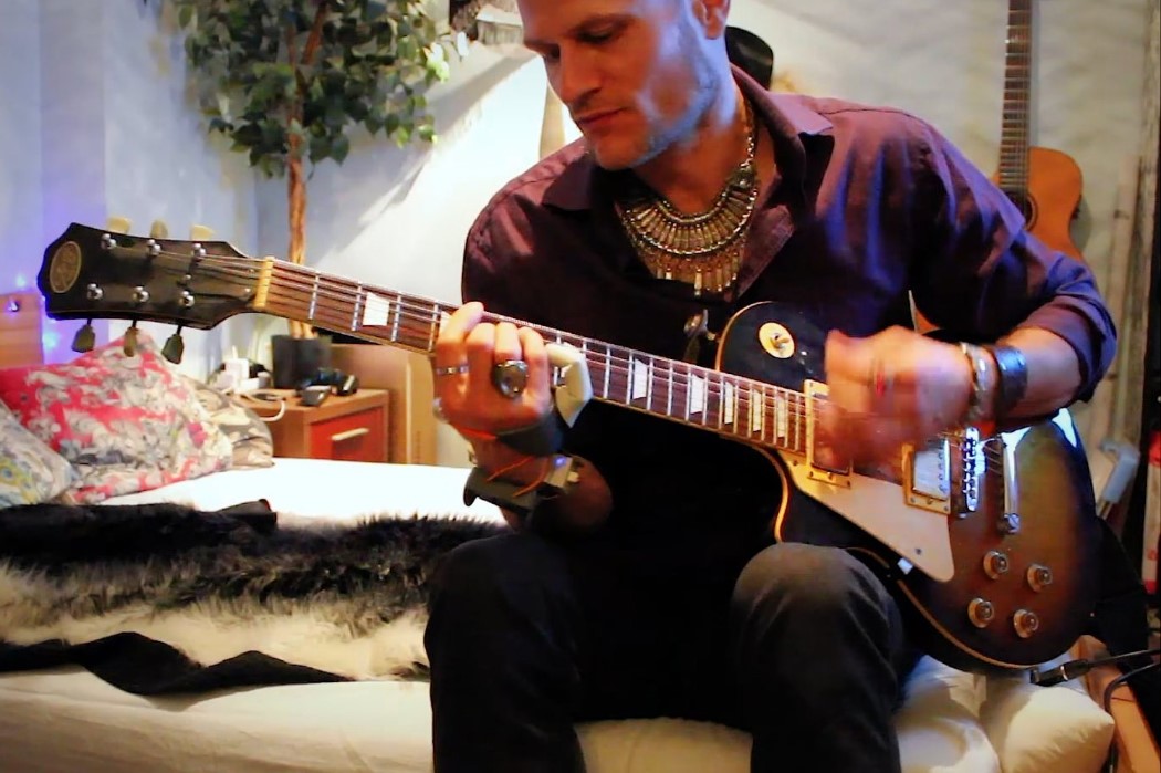 intelligence，a prosthesis，3D printing，