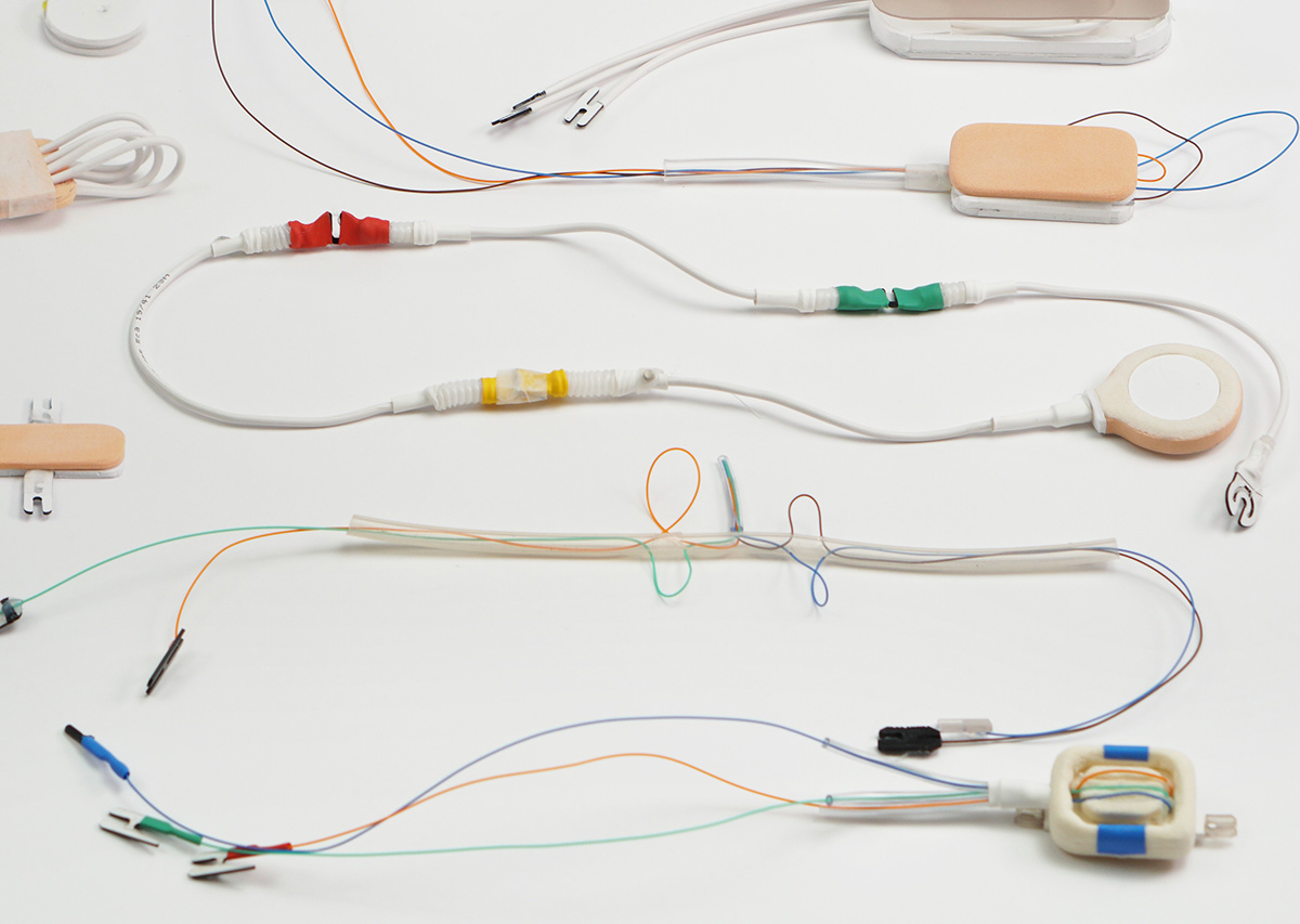 ECG monitoring，intensive care ，sensor，