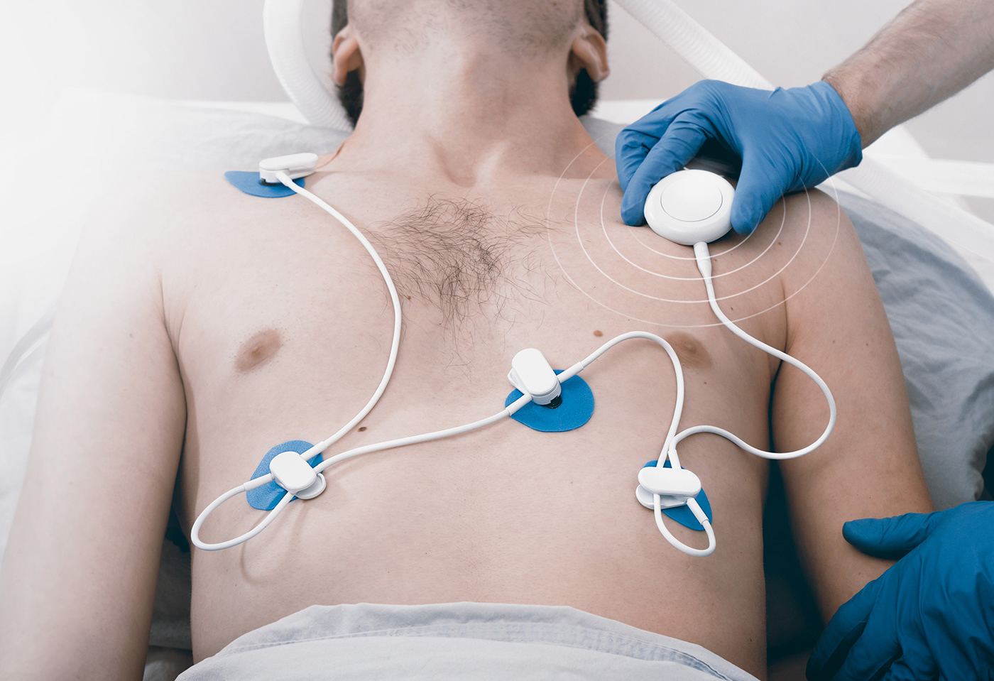 ECG monitoring，intensive care ，sensor，