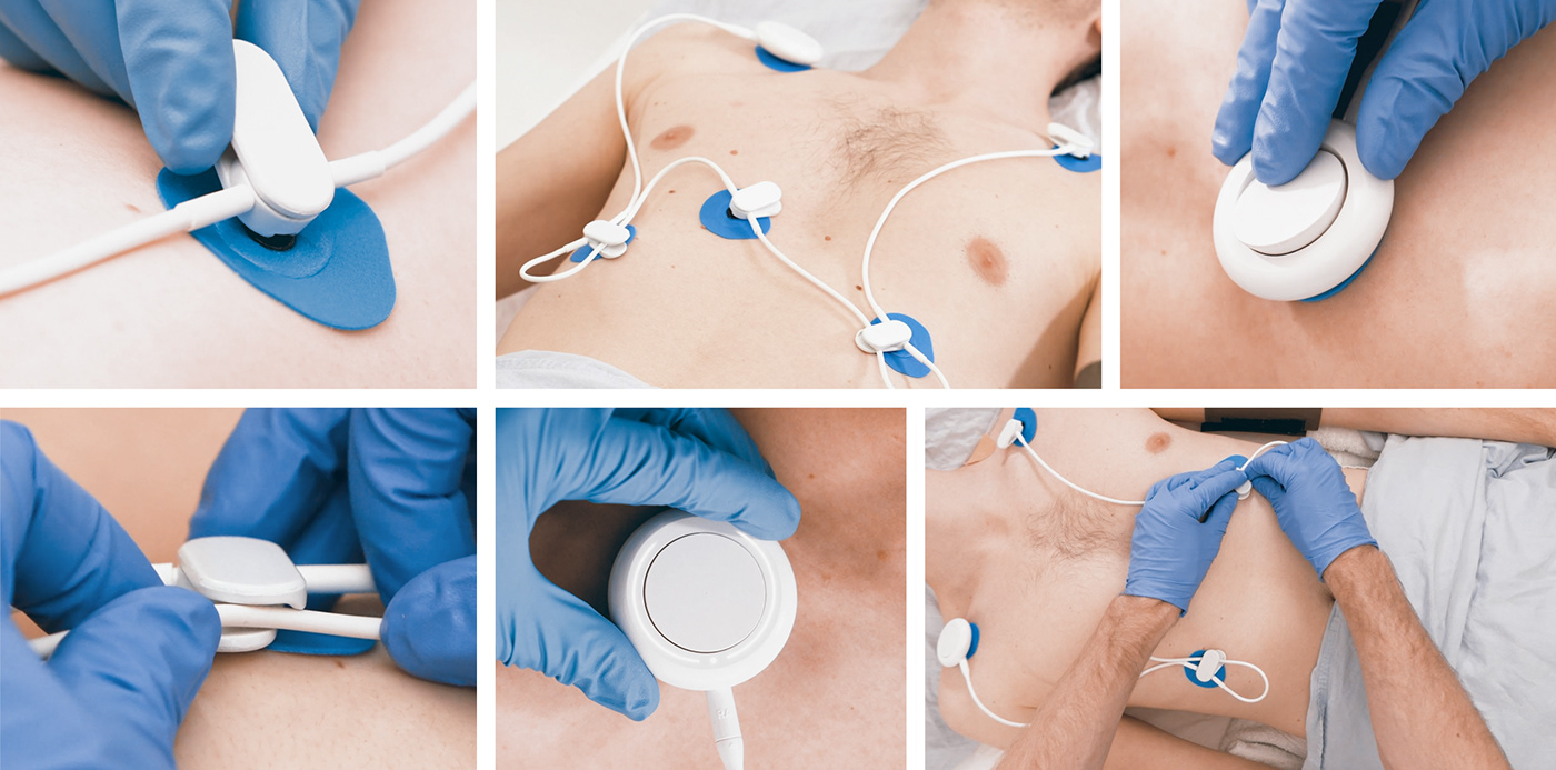 ECG monitoring，intensive care ，sensor，