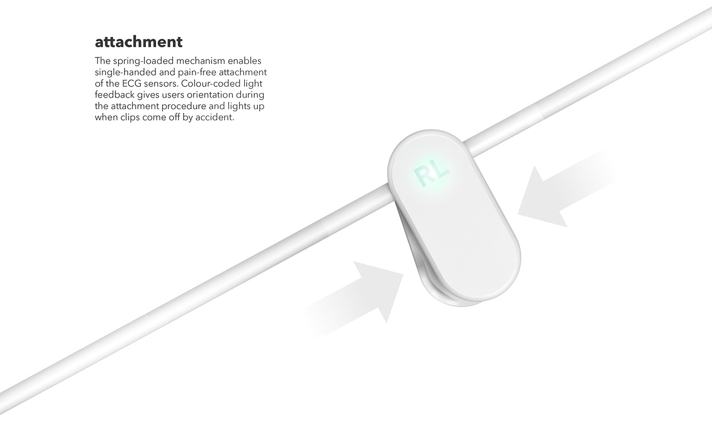 ECG monitoring，intensive care ，sensor，