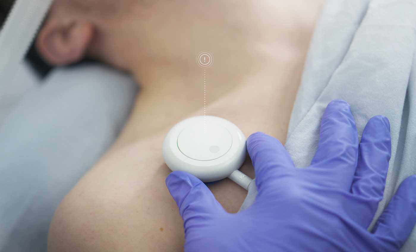 ECG monitoring，intensive care ，sensor，