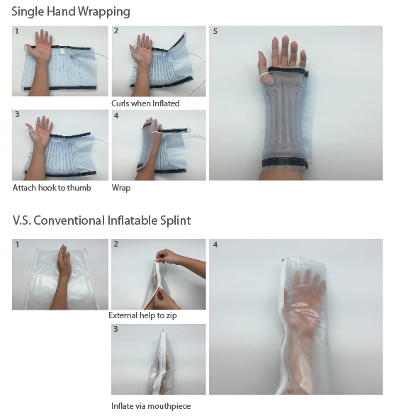 fracture，self-winding ，Pneumatic equipment，Pneumatic splint，Medical tools，