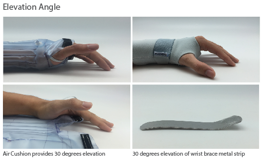 fracture，self-winding ，Pneumatic equipment，Pneumatic splint，Medical tools，