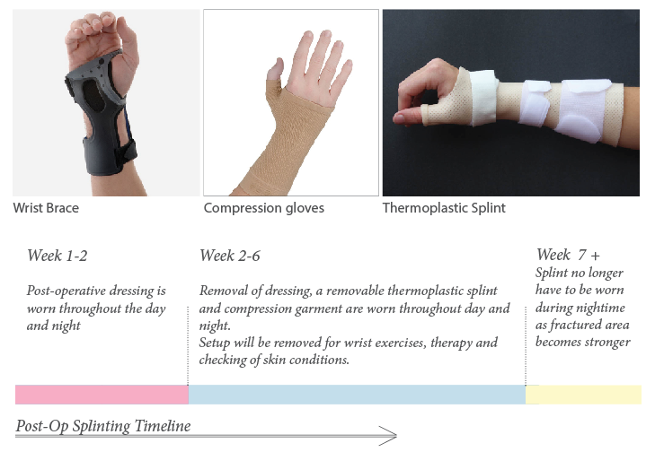 fracture，self-winding ，Pneumatic equipment，Pneumatic splint，Medical tools，