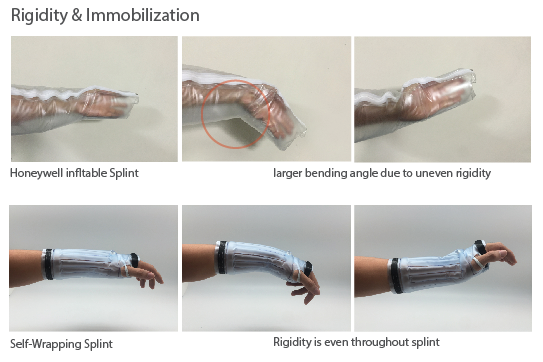 fracture，self-winding ，Pneumatic equipment，Pneumatic splint，Medical tools，