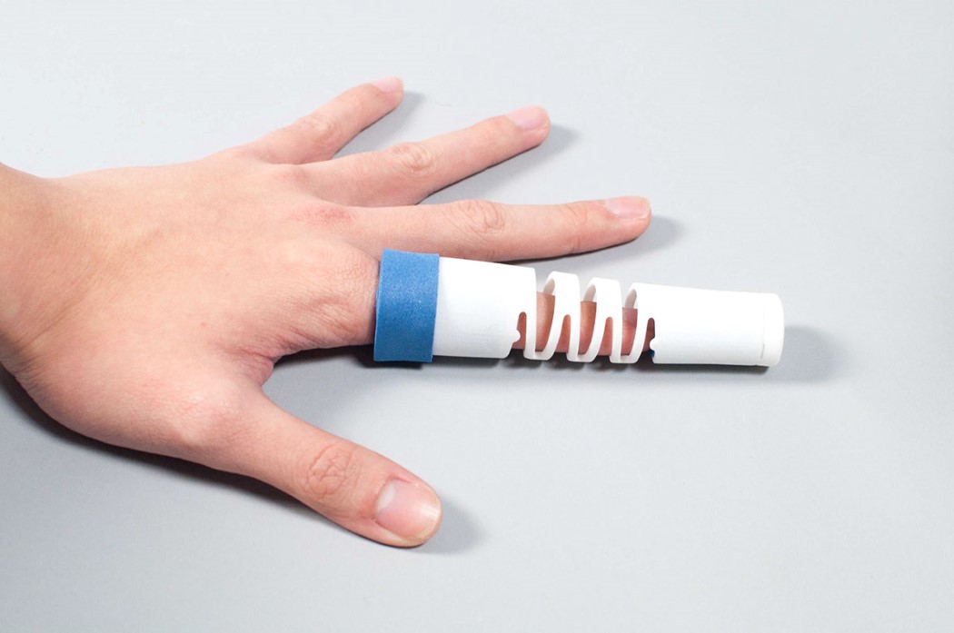 medical care，bend，fracture，finger，polymer，