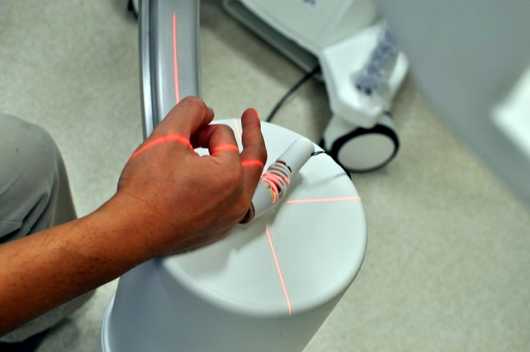 medical care，bend，fracture，finger，polymer，