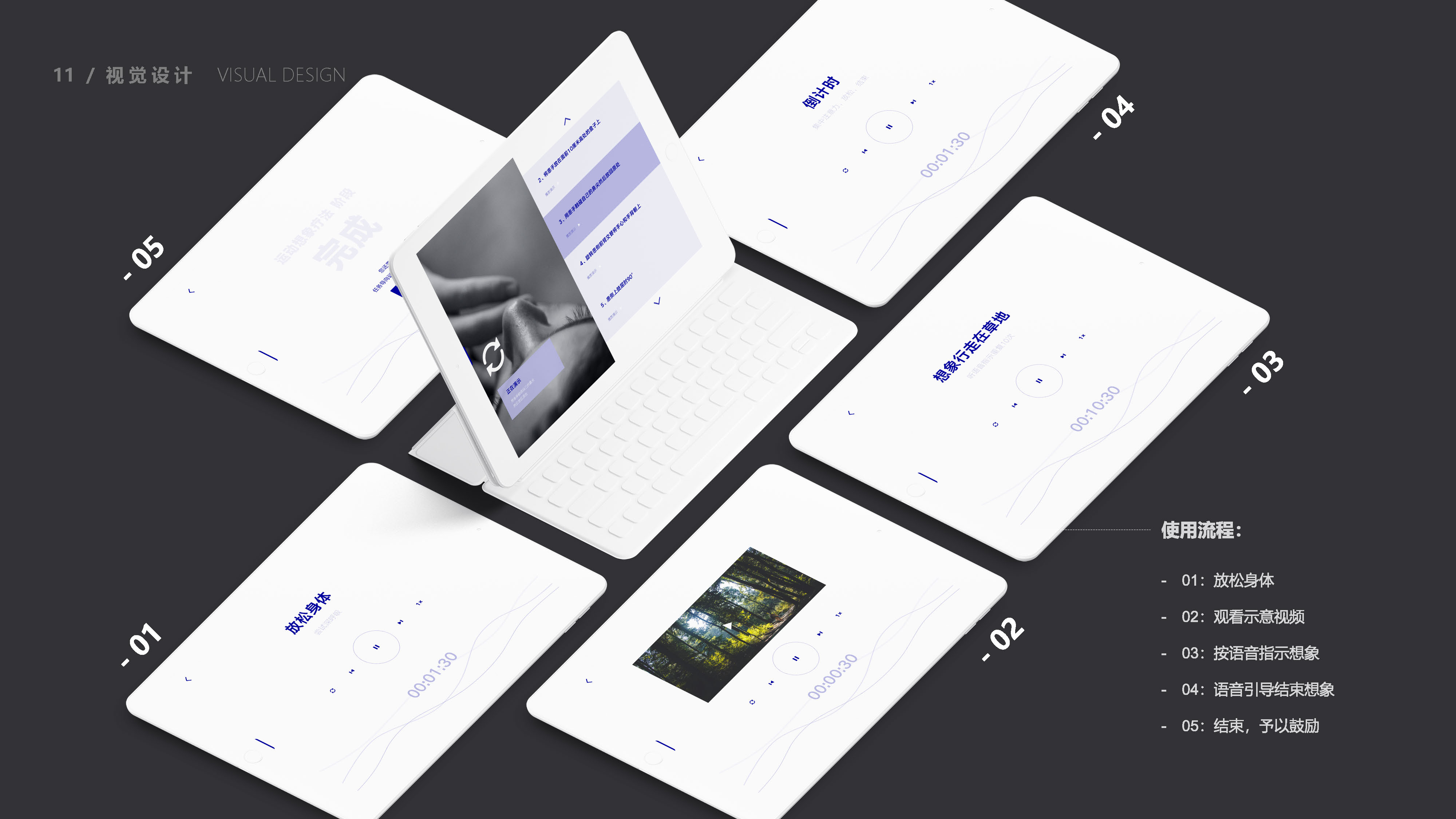 cerebral apoplexy，Exercise therapy，Task oriented training，EMG biofeedback，