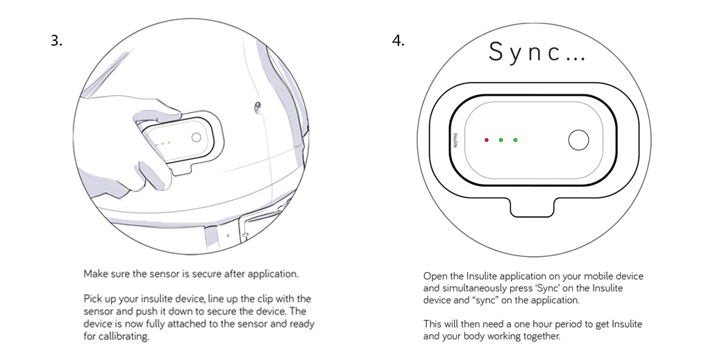 Insulite，Diabetes，insulin，