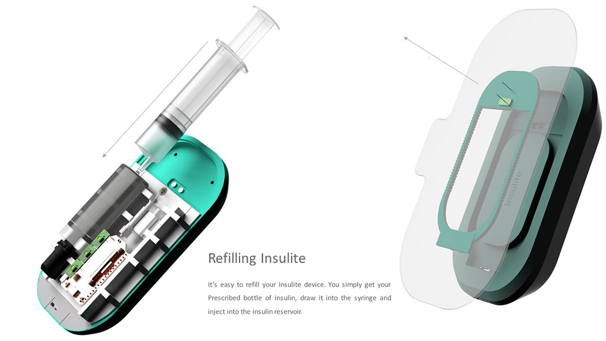 Insulite，Diabetes，insulin，