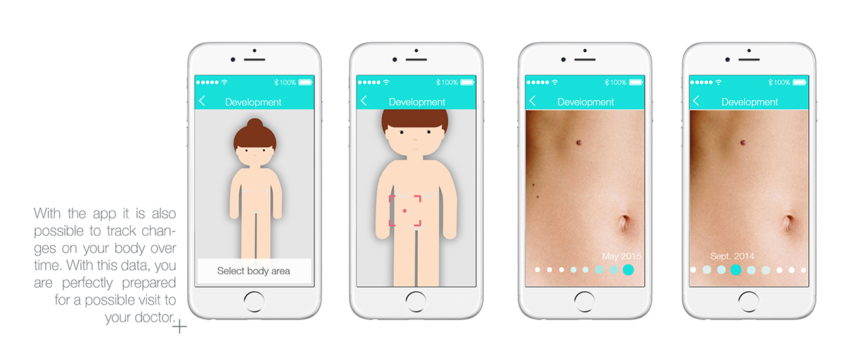 Philips，brand，Medical products，Skin cancer，Scanner，