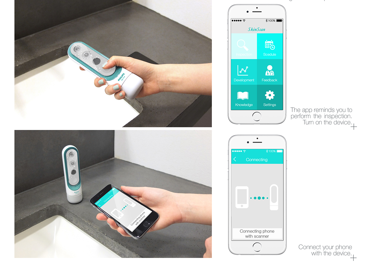 Philips，brand，Medical products，Skin cancer，Scanner，