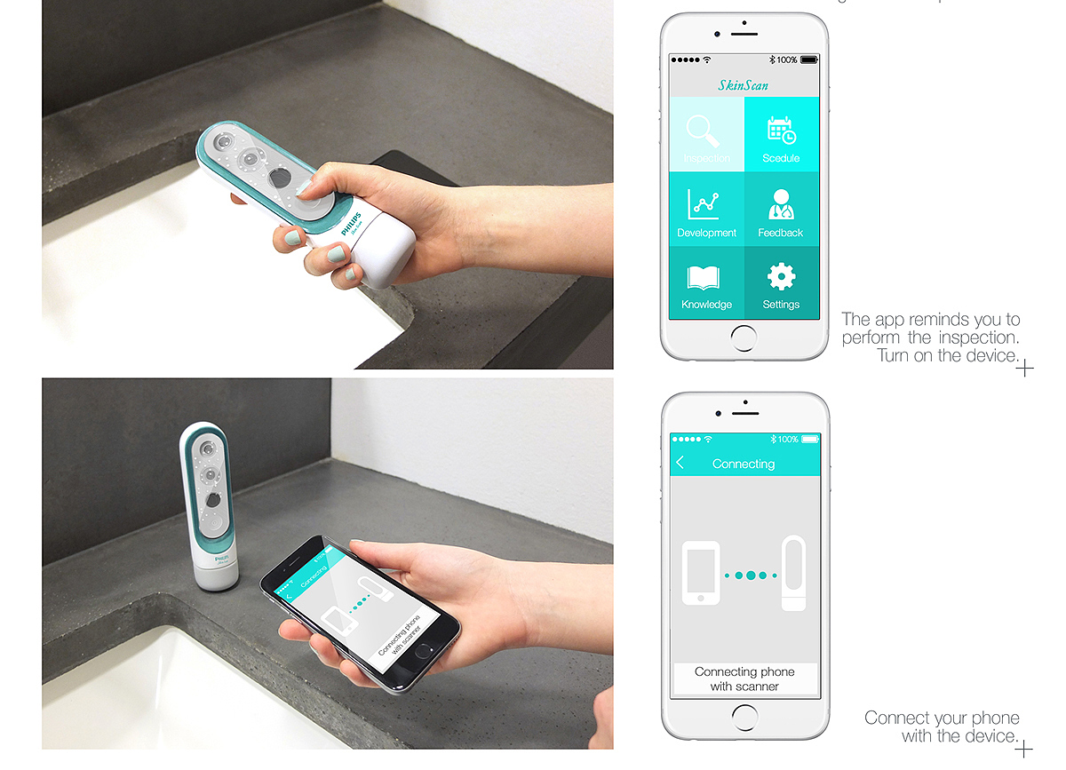 Philips，brand，Medical products，Skin cancer，Scanner，