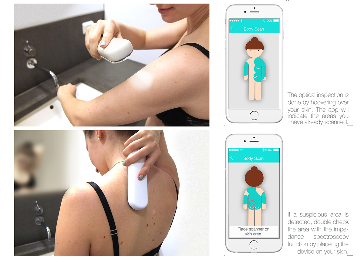 Philips，brand，Medical products，Skin cancer，Scanner，