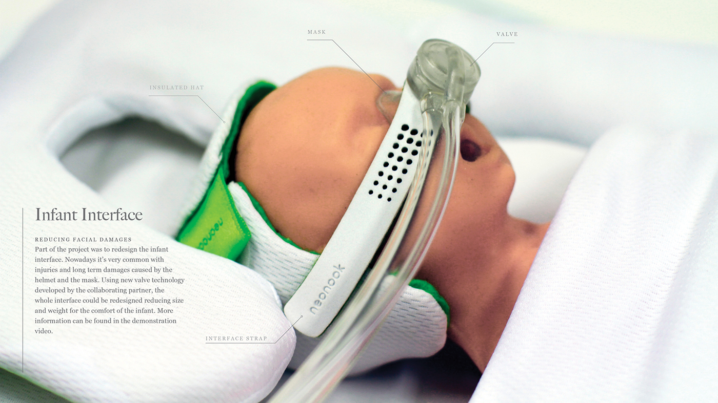 baby，2014C77DA，2014EDEA，2014 red dot，medical care，uterus，Respiratory assistance，