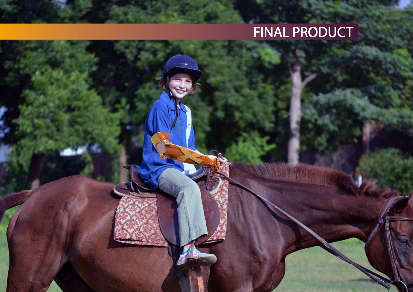 children，Prosthesis，product design，industrial design，